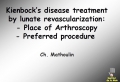 kienbock microsurgery and treatment  [ Dorsal Middle Bone Pain  ]